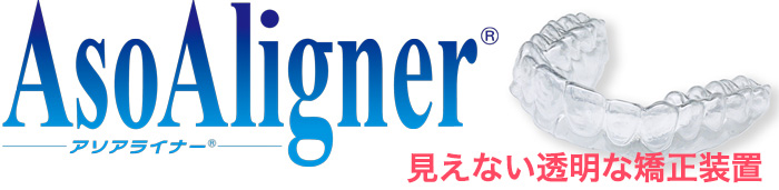 アライナー