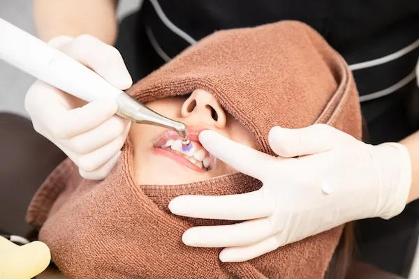 歯のクリーニング