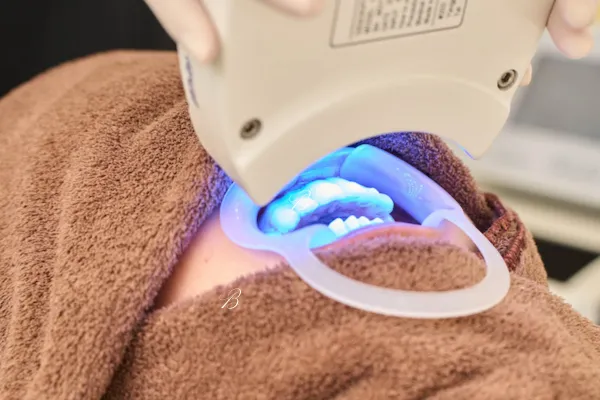 歯を白くするホワイトニング 歯を白くするホワイトニング