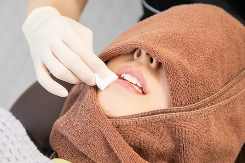 歯の白さのシェードチェック