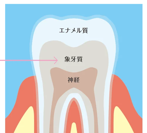 歯の内部にある象牙質の黄ばみ
