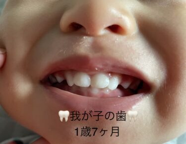 子ども歯＝乳歯の生える順番のお話
