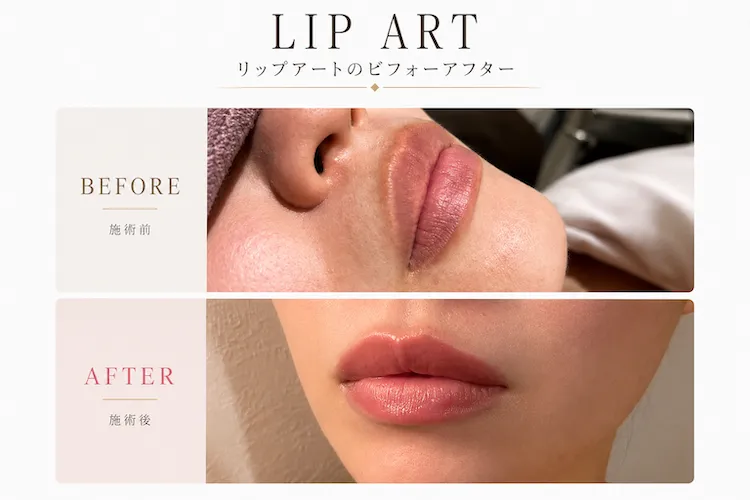唇のくすみや血色感のなさに悩む方へ