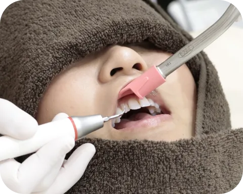 歯にこびりついた歯垢・歯石をごっそり除去
