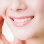 差し歯が多い60代女性をホワイトニングした症例