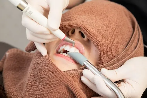 ホワイトニング剤塗布