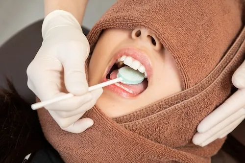 シェードチェック