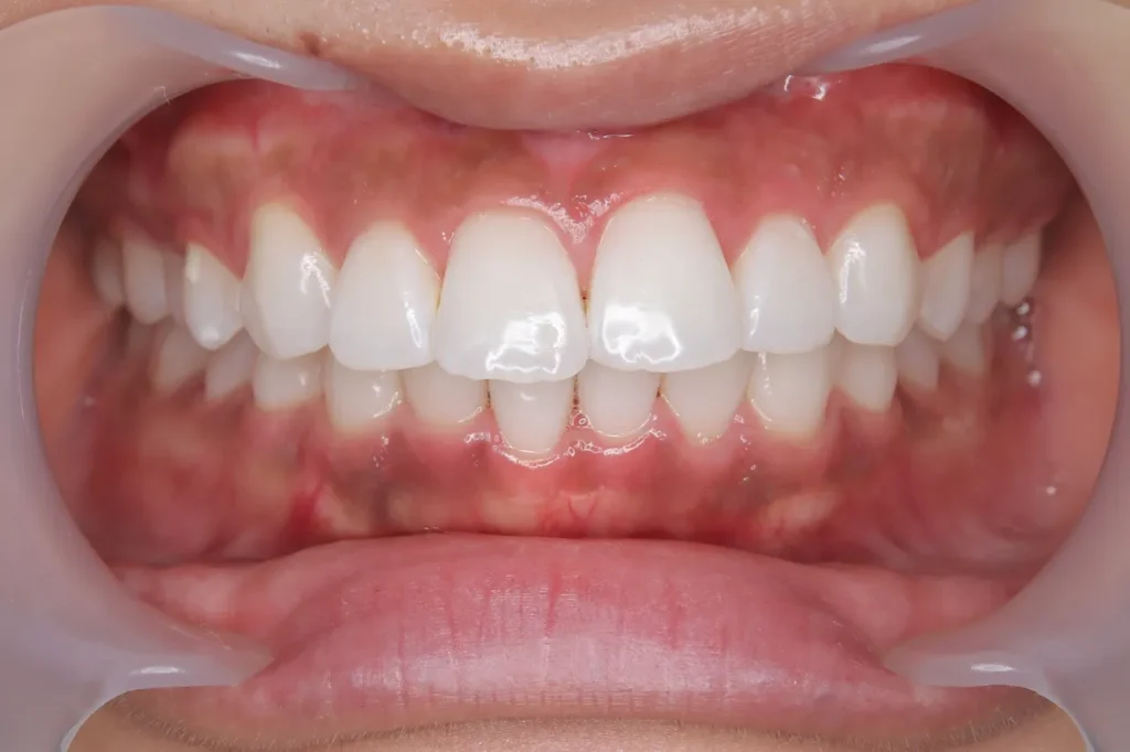 image-43 - arisa tkd