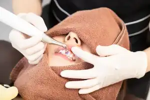 名古屋で受けるデンタルエステとクリーニングのイメージ