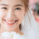 挙式前の美白ケア｜結婚式に向けたホワイトニング経過